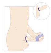 Vacuum Erection Devices